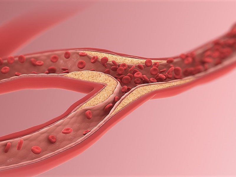 1200px-arteriole_resize.jpg