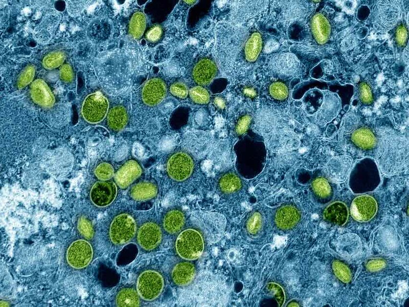 16_aug_mpox_virus_081424.jpg