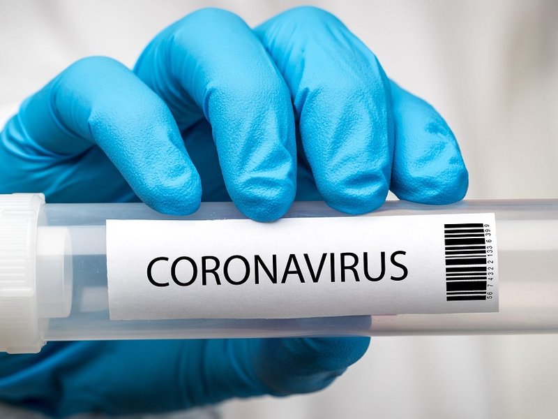 coronavirus_test.jpg