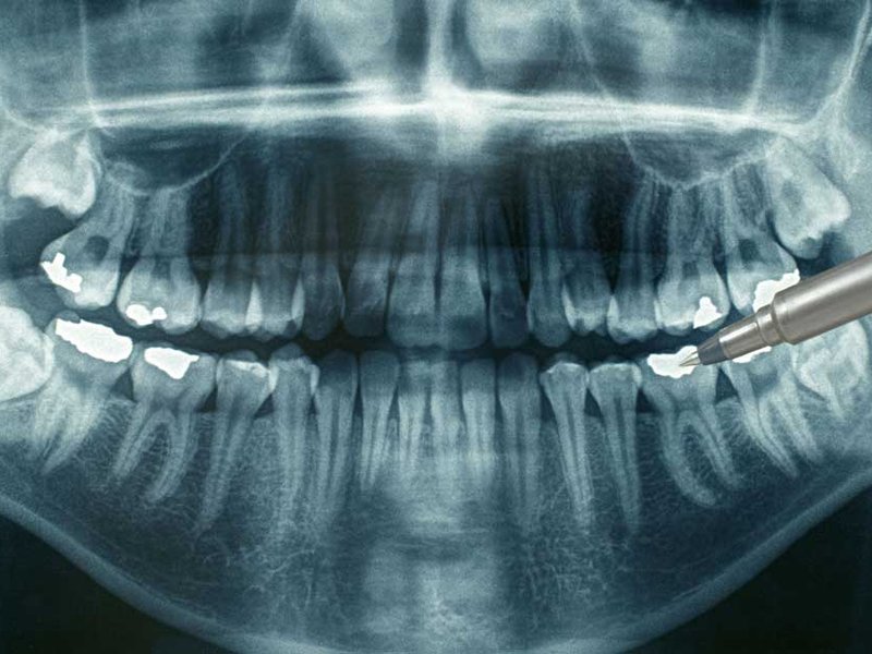 dental-xrays.jpg