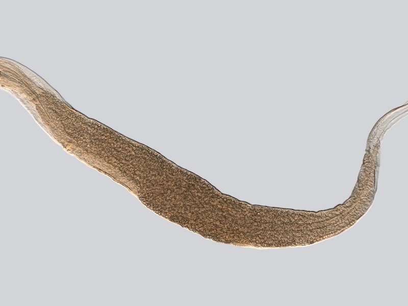 enterobius_vermicularis_(ypm_iz_093279).jpg