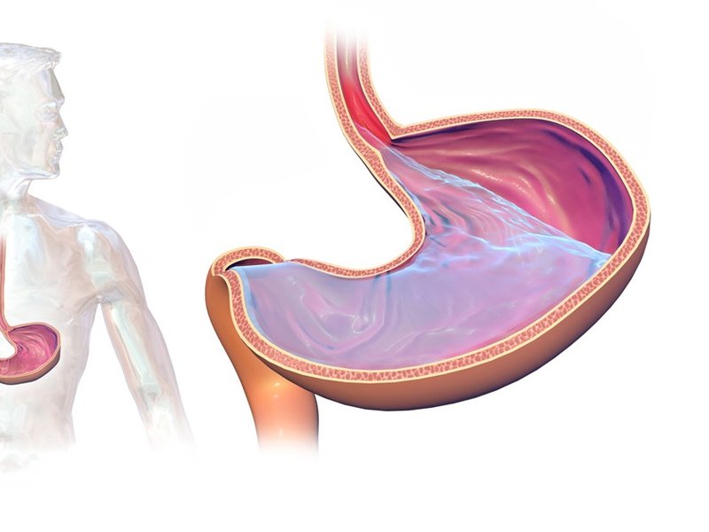 gastroesophageal_reflux_disease_(gerd).jpg