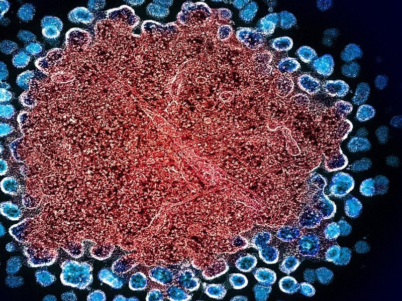 hiv-1_virus_particles_replicating_(52532878449).jpg