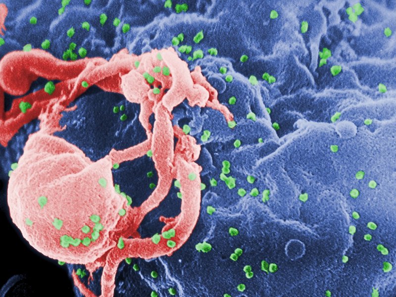 hiv-budding-color.jpg