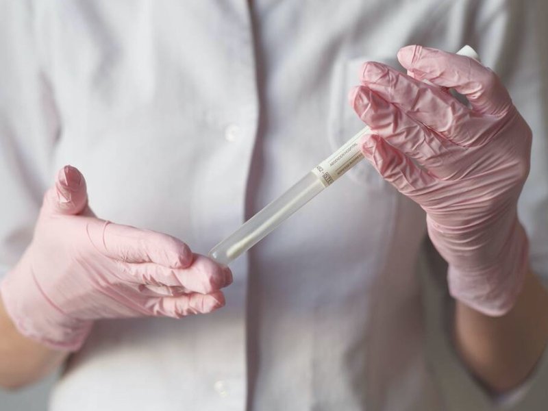 hpv:swab.jpg