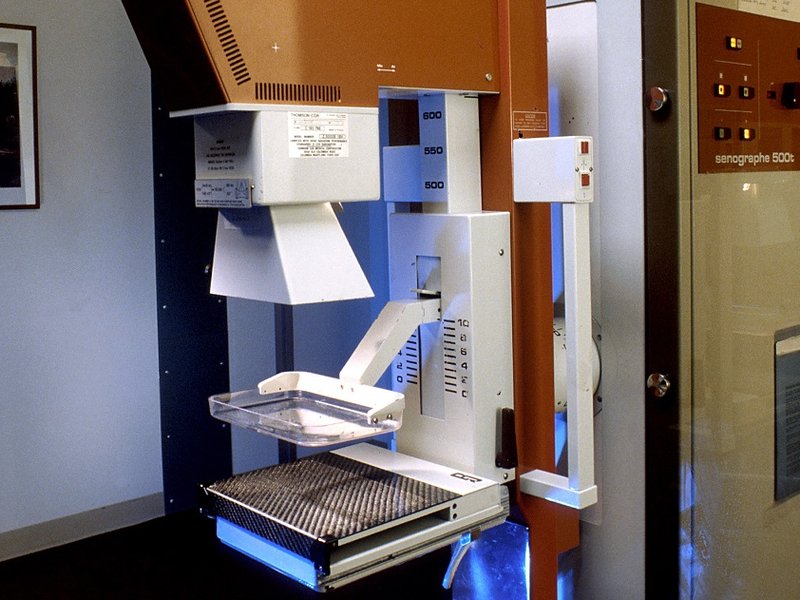 mammography_machine_resize.jpg