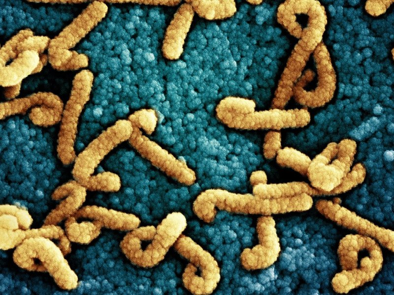 marburg_virus_particles_(52774910982)_resize.jpg