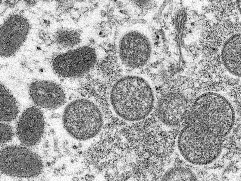 monkeypox_virion_-_cdc.png