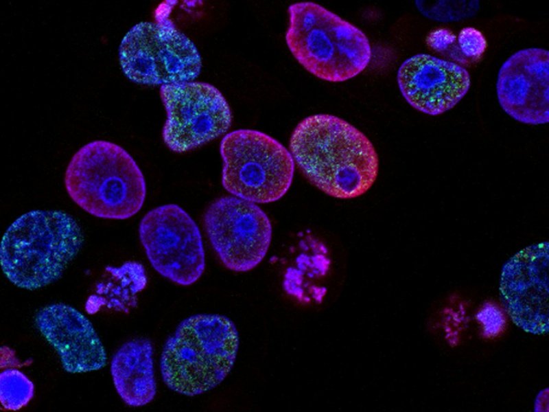 national-cancer-institute-l7en7lb-ovc-unsplash_1.jpg