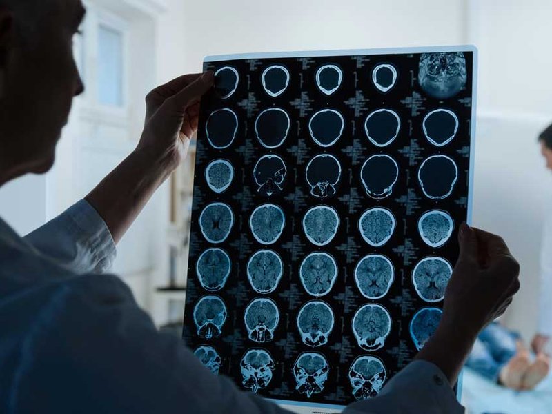 oncologist-mri-08022019.jpg