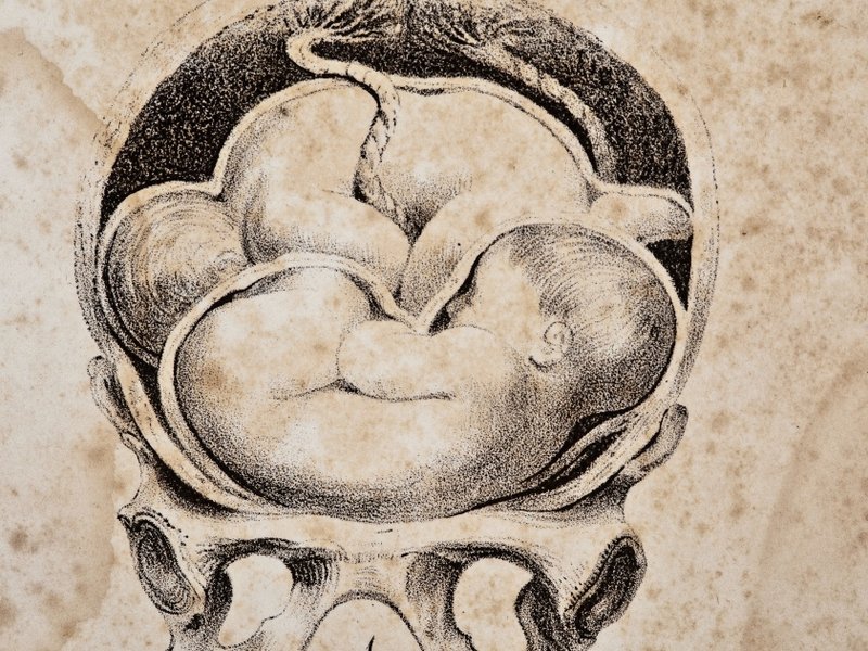 pts_placenta.jpg