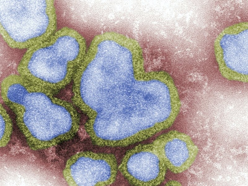 spanishflu.jpg
